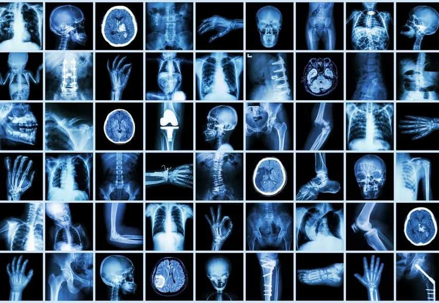 Kto odkrył promienie X i jak zmieniły świat medycyny?