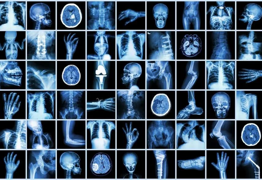 Kto odkrył promienie X i jak zmieniły świat medycyny?